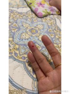 被仓鼠咬了出了一丁点血_仓鼠咬伤流血？肥皂水清洗碘伏消毒！