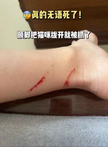 剪了指甲的猫还能把人抓流血吗_猫抓伤别慌，速冲消毒看情况
