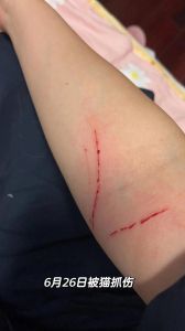 不知道是否是被猫抓伤_猫抓伤要当心，狂犬破伤风，及时就医打疫苗！