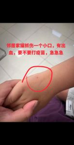 被猫挠出血了第二天才知道_猫抓出血两天要处理，消毒防感染，狂犬病风险要注意