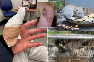 人被松鼠咬了有没有事_松鼠咬伤？清洗止血快就医，警惕感染！