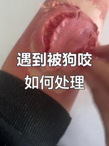 手破皮了被狗子舔了一口_被狗舔伤？速冲消毒！