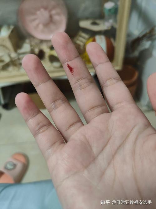 让仓鼠咬破一点出点血没事吗_仓鼠咬伤别大意,出血多或红肿快就医 让仓鼠咬破一点出点血没事吗_仓鼠咬伤别大意,出血多或红肿快就医