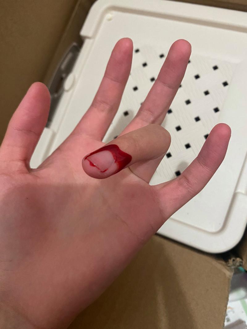 让仓鼠咬破了手有事吗_防感染,狂犬病概率低 让仓鼠咬破了手有事吗_防感染,狂犬病概率低