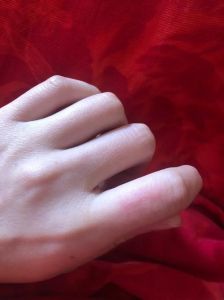 家养的猫抓了用水冲_猫抓伤别慌，冲洗消毒快打疫苗