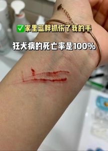 被家养的猫抓了一下_猫抓伤别大意，正确处理很重要！
