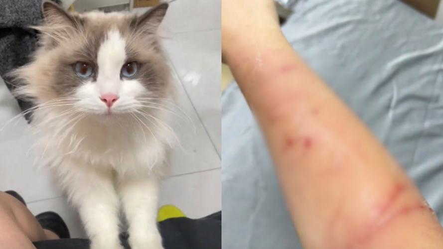 中国有人死于被猫咬伤吗_猫抓伤致命!伤口处理和疫苗不容忽视 中国有人死于被猫咬伤吗_猫抓伤致命!伤口处理和疫苗不容忽视