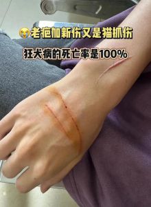 被自家养的猫抓破了怎么办_猫抓伤别大意，清洗消毒快就医