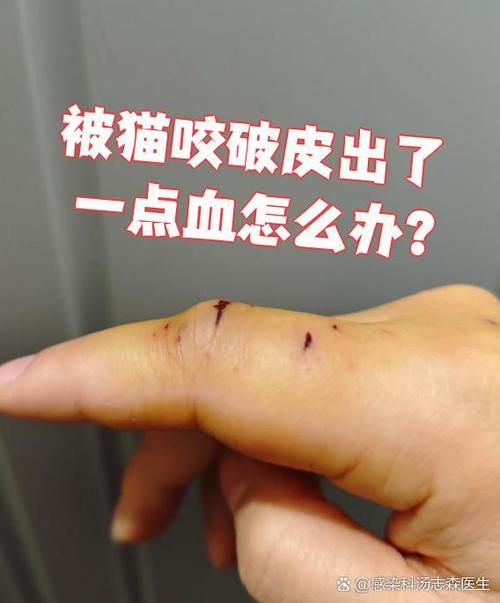 被家猫咬了一个小孔就一丁点血_猫咬伤别大意,立即清洗消毒观察,必要时打疫苗! 被家猫咬了一个小孔就一丁点血_猫咬伤别大意,立即清洗消毒观察,必要时打疫苗!