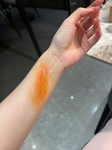 被家养的猫咪抓出血了_猫抓伤出血怎么办？正确处理与注意事项