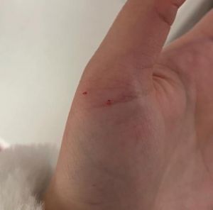 被幼猫咬了一个小孔就一丁点血_幼猫咬伤别大意，速冲消毒打疫苗！