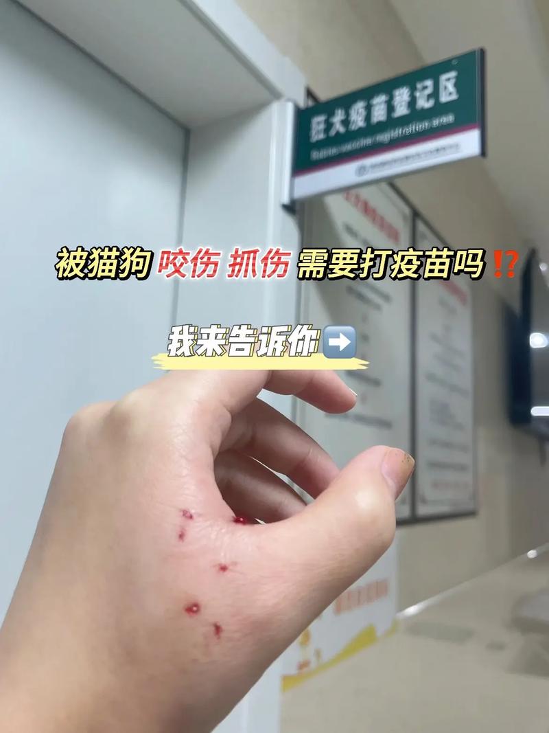 被两个月的宠物猫抓了要打针吗_小猫抓伤流血,需打疫苗吗?速咨询医生! 被两个月的宠物猫抓了要打针吗_小猫抓伤流血,需打疫苗吗?速咨询医生!